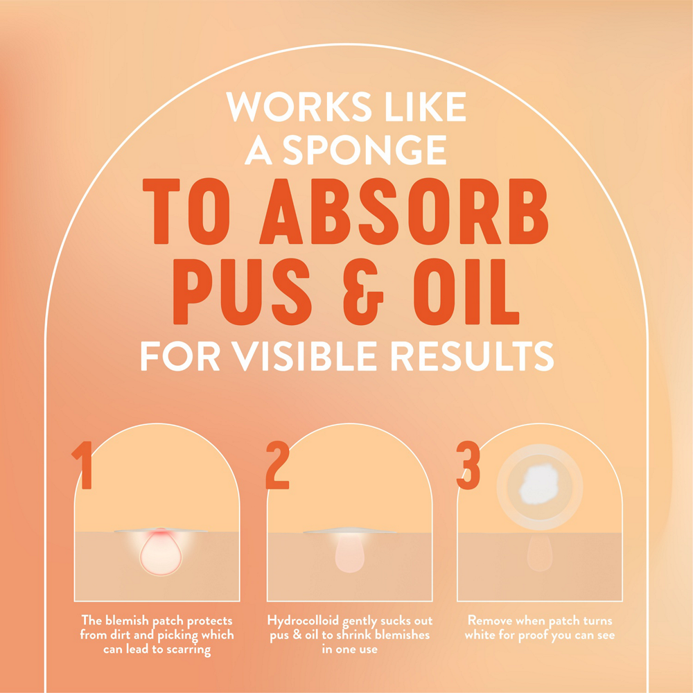 English: Protects from dirt and picking which can lead to scarring. Hydrocolloid gently sucks out pus & oil to shrink blemishes in one use. Remove when patch turns white for proof you can see Français: Protège contre les saletés et le tripotage qui peut laisser des cicatrices. L’hydrocolloïde absorbe le pus et le sébum en douceur pour réduire la taille des boutons en un usage. Retirer le timbre lorsqu’il devient blanc pour des résultats vraiment visibles.