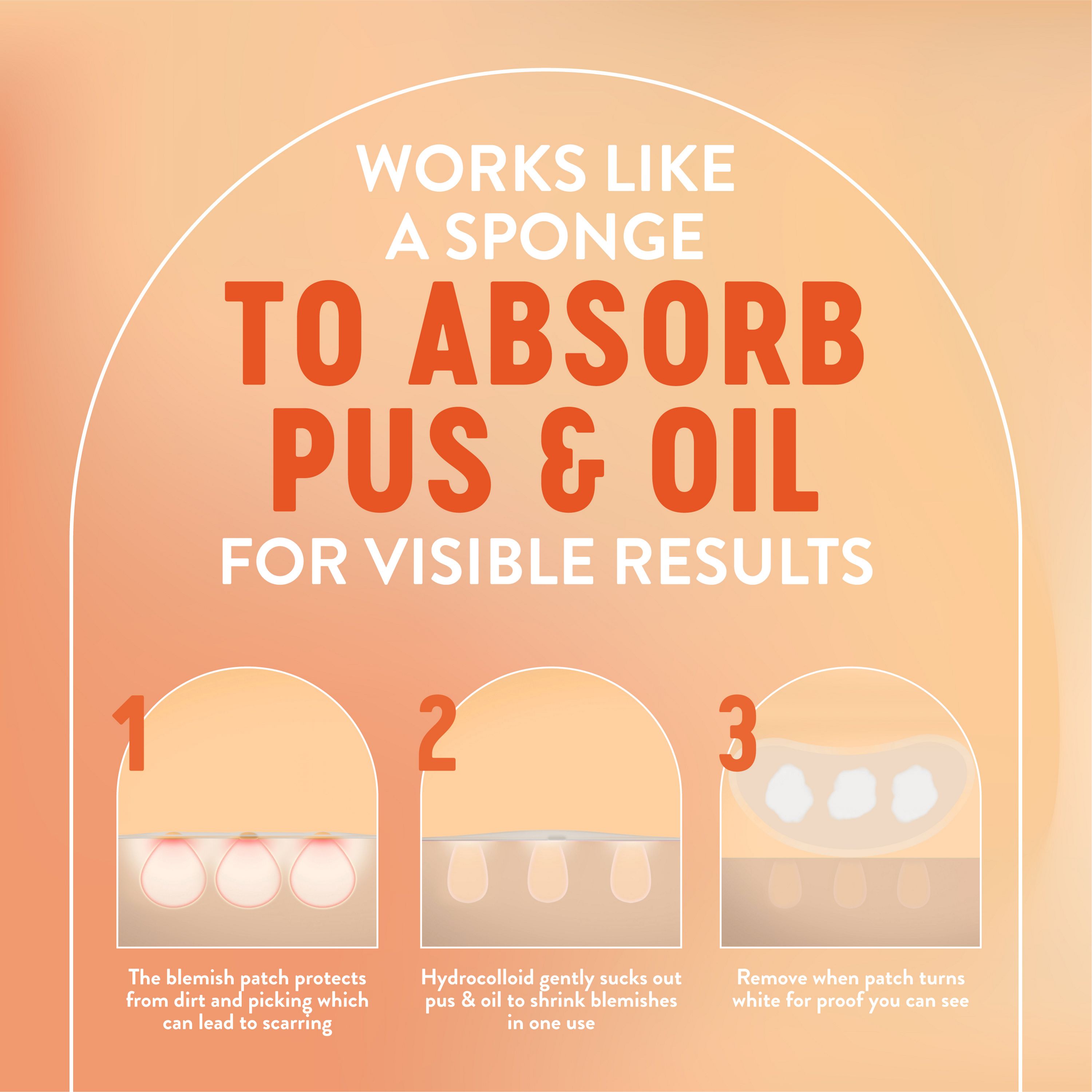 English: Protects from dirt and picking which can lead to scarring. Hydrocolloid gently sucks out pus & oil to shrink blemishes in one use. Remove when patch turns white for proof you can see. Français: Protège contre les saletés et le tripotage qui peut laisser des cicatrices. L’hydrocolloïde absorbe le pus et le sébum en douceur pour réduire la taille des boutons en un usage. Retirer le timbre lorsqu’il devient blanc pour des résultats vraiment visibles.