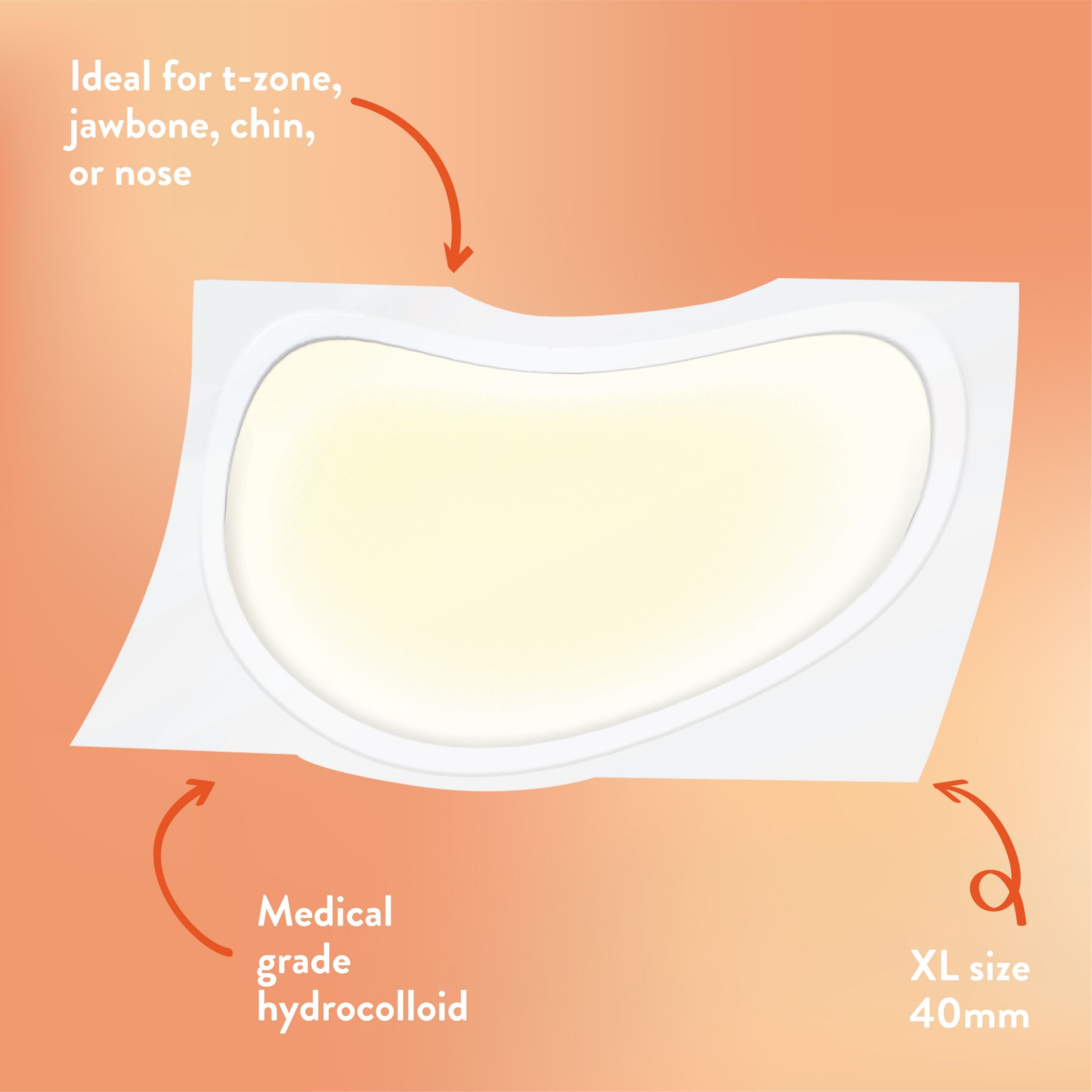 English: Ideal for t-zone, jawbone, chin, or nose. Medical grade hydrocolloid. XLsize 40mm Français: Idéal pour le nez, le front, le menton ou la mâchoire. Hydrocolloïde de qualité médicale. Format TG de 40 mm