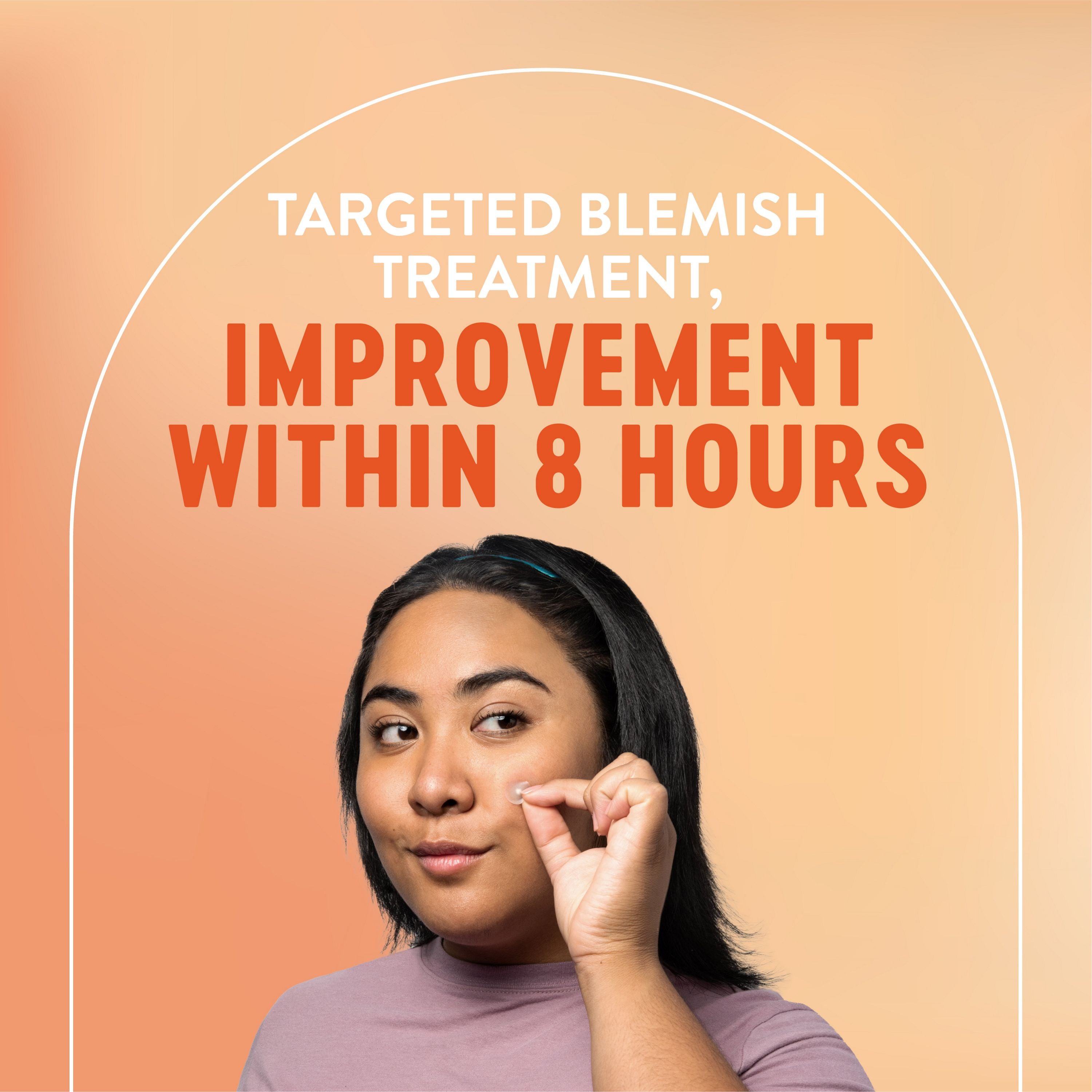 English: Targeted blemish treatment, improvement within 8 hours. Français: Traitement ciblé de l’acné, amélioration dans les 8 heures.